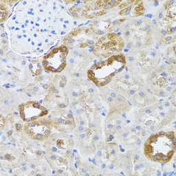 Anti-RNase L antibody used in IHC (Paraffin sections) (IHC-P). GTX64577