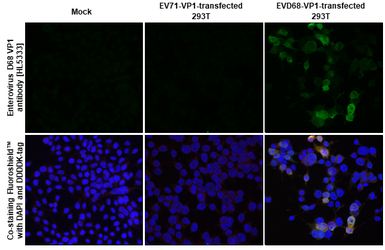 Anti-Enterovirus D68 VP1 antibody [HL5333] used in Immunocytochemistry/ Immunofluorescence (ICC/IF). GTX645811