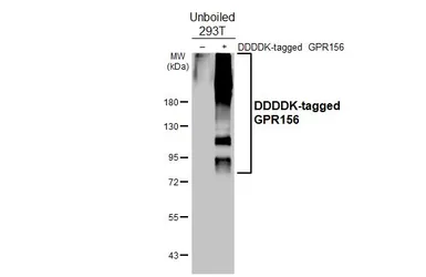 Anti-GPR156 antibody [HL5372] used in Western Blot (WB). GTX645850
