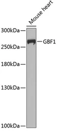 Anti-GBF1 antibody used in Western Blot (WB). GTX64594