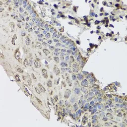 Anti-GBF1 antibody used in IHC (Paraffin sections) (IHC-P). GTX64594