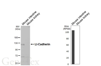 Anti-LI-Cadherin antibody [HL5395] used in Western Blot (WB). GTX645963