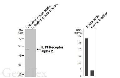 Anti-IL13 Receptor alpha 2 antibody [HL5407] used in Western Blot (WB). GTX645975