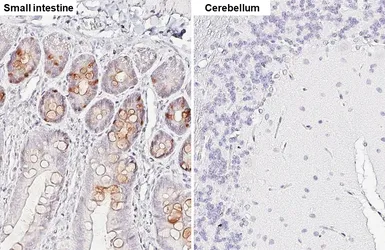 Anti-SPINK4 antibody [HL5418] used in IHC (Paraffin sections) (IHC-P). GTX645986