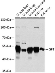 Anti-GPT antibody used in Western Blot (WB). GTX64602