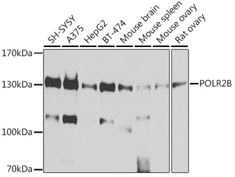 Anti-RPB2 antibody used in Western Blot (WB). GTX64604