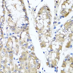 Anti-TSG6 antibody used in IHC (Paraffin sections) (IHC-P). GTX64605
