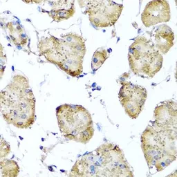 Anti-STK3 antibody used in IHC (Paraffin sections) (IHC-P). GTX64607
