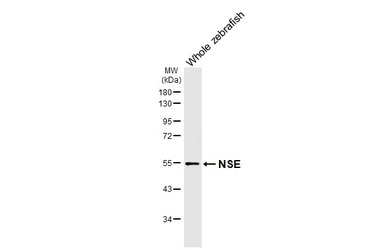 Anti-NSE antibody [HL5436] used in Western Blot (WB). GTX646078