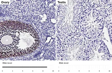Anti-Inhibin beta A antibody [HL5443] used in IHC (Paraffin sections) (IHC-P). GTX646085