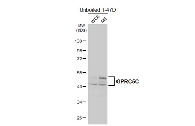 Anti-GPRC5C antibody [HL5446] used in Western Blot (WB). GTX646088