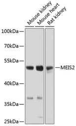Anti-MEIS2 antibody used in Western Blot (WB). GTX64612