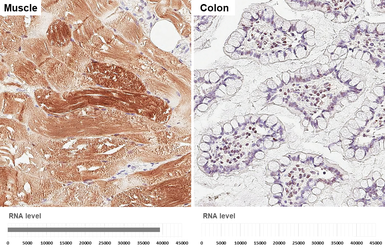 Anti-Myoglobin antibody [HL5480] used in IHC (Paraffin sections) (IHC-P). GTX646144