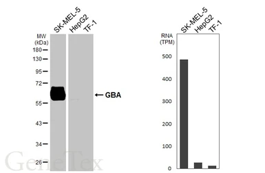 Anti-GBA antibody [HL5482] used in Western Blot (WB). GTX646146