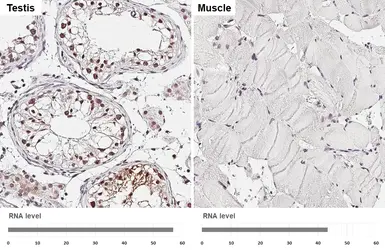Anti-USP7 antibody [HL5485] used in IHC (Paraffin sections) (IHC-P). GTX646149