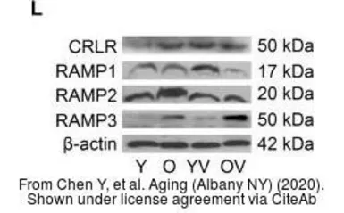Anti-CRLR antibody used in Western Blot (WB). GTX64616