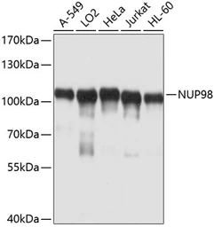 Anti-NUP98 antibody used in Western Blot (WB). GTX64618