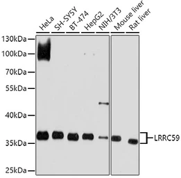 Anti-LRRC59 antibody used in Western Blot (WB). GTX64620