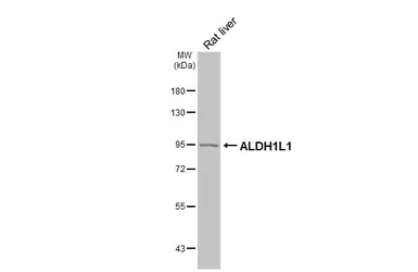 Anti-ALDH1L1 antibody [HL5536] used in Western Blot (WB). GTX646210