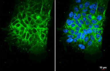 Anti-Claudin 1 antibody [HL5538] used in Immunocytochemistry/ Immunofluorescence (ICC/IF). GTX646212
