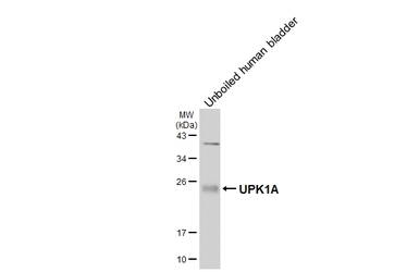 Anti-UPK1A antibody [HL5541] used in Western Blot (WB). GTX646215
