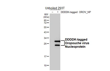 Anti-Oropouche virus Nucleoprotein antibody [HL5558] used in Western Blot (WB). GTX646232