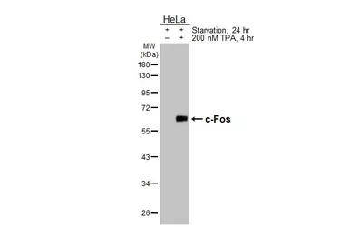 Anti-c-Fos antibody [HL5568] used in Western Blot (WB). GTX646242