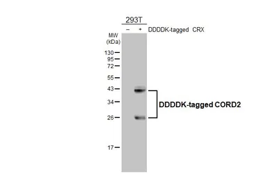 Anti-CORD2 antibody [HL5578] used in Western Blot (WB). GTX646260