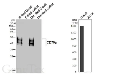 Anti-CD79a antibody [HL5600] used in Western Blot (WB). GTX646282