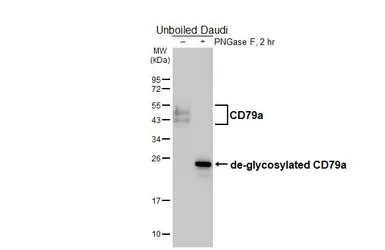 Anti-CD79a antibody [HL5600] used in Western Blot (WB). GTX646282