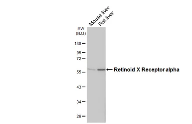Anti-Retinoid X Receptor alpha antibody [HL5602] used in Western Blot (WB). GTX646284