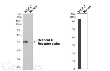 Anti-Retinoid X Receptor alpha antibody [HL5602] used in Western Blot (WB). GTX646284
