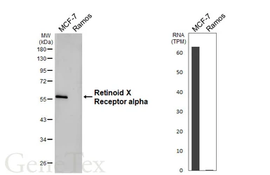 Anti-Retinoid X Receptor alpha antibody [HL5604] used in Western Blot (WB). GTX646286