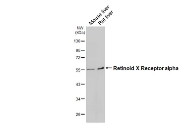 Anti-Retinoid X Receptor alpha antibody [HL5604] used in Western Blot (WB). GTX646286