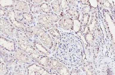 Anti-Retinoid X Receptor alpha antibody [HL5604] used in IHC (Paraffin sections) (IHC-P). GTX646286