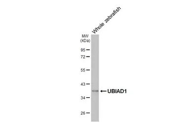 Anti-UBIAD1 antibody [HL5615] used in Western Blot (WB). GTX646297