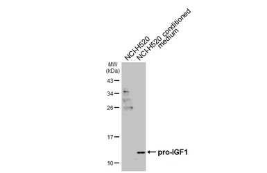 Anti-IGF1 antibody [GT360] used in Western Blot (WB). GTX646302