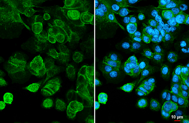 Anti-LI-Cadherin antibody [HL5636] used in Immunocytochemistry/ Immunofluorescence (ICC/IF). GTX646325