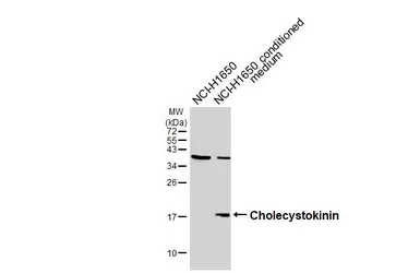 Anti-Cholecystokinin antibody [HL5639] used in Western Blot (WB). GTX646328