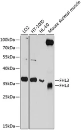 Anti-FHL3 antibody used in Western Blot (WB). GTX64633