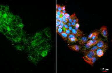 Anti-Fibrinogen gamma antibody [HL5648] used in Immunocytochemistry/ Immunofluorescence (ICC/IF). GTX646457