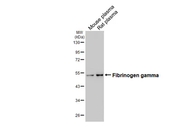 Anti-Fibrinogen gamma antibody [HL5648] used in Western Blot (WB). GTX646457