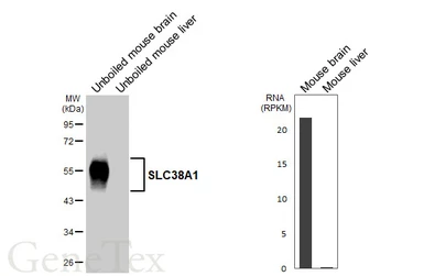 Anti-SLC38A1 antibody [HL5650] used in Western Blot (WB). GTX646459