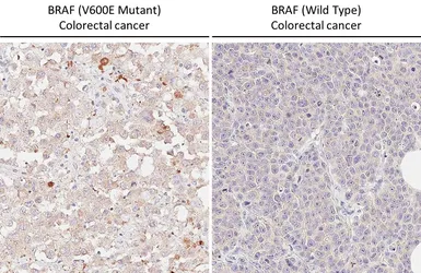 Anti-B-Raf (V600E Mutant) antibody [HL5673] used in IHC (Paraffin sections) (IHC-P). GTX646482