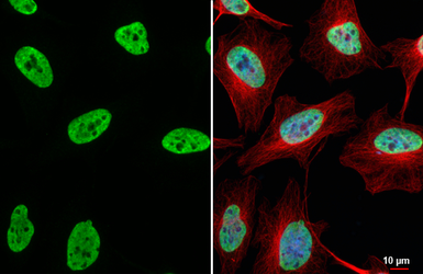 Anti-HNRNPA3 antibody [HL5675] used in Immunocytochemistry/ Immunofluorescence (ICC/IF). GTX646484
