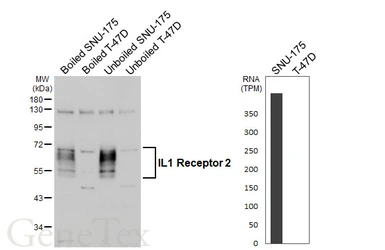 Anti-IL1 Receptor 2 antibody [HL5679] used in Western Blot (WB). GTX646488