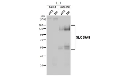 Anti-SLC39A8 antibody [HL5690] used in Western Blot (WB). GTX646521