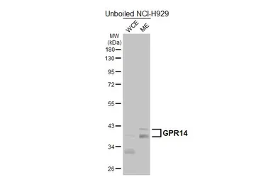 Anti-GPR14 antibody [HL5695] used in Western Blot (WB). GTX646526
