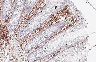 Anti-CD45 antibody [HL5696] used in IHC (Paraffin sections) (IHC-P). GTX646527