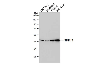 Anti-TDP43 antibody [HL5702] used in Western Blot (WB). GTX646533